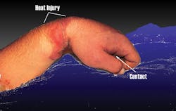 Ecmweb Com Sites Ecmweb com Files Uploads 2014 05 Physical Effects Of Electric Shock Ecmweb Com Sites Ecmweb com Files Uploads 2014 05 Physical Effects Of Electric Shock