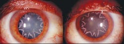 eyes damaged from shock eyes damaged from shock