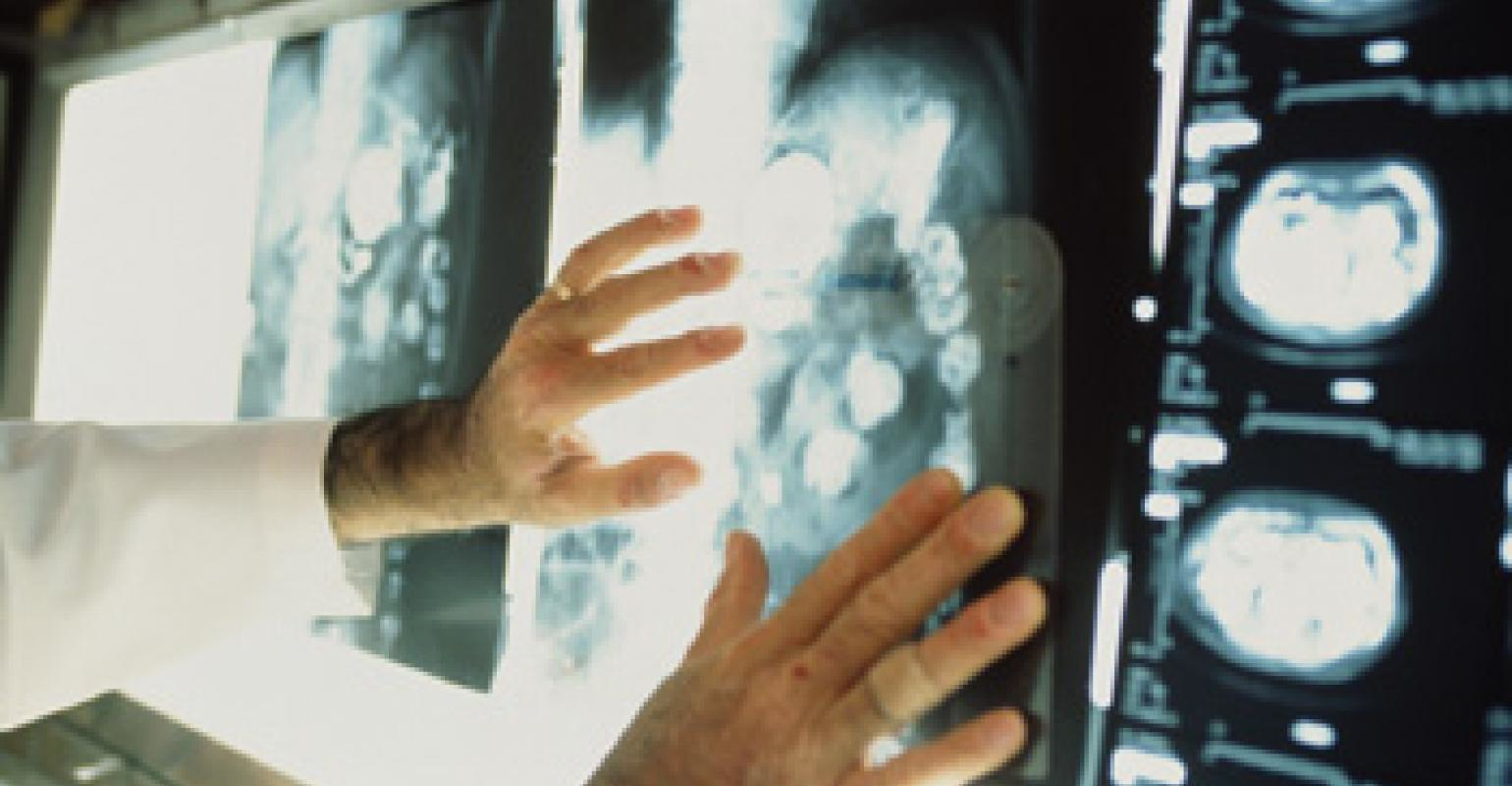 x-ray results doctors office