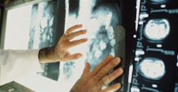 x-ray results doctors office x-ray results doctors office