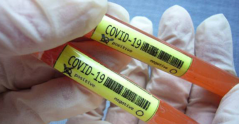 Coronavirus Testing Sample 5e7e1c1e0e209
