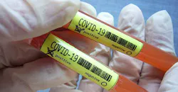 Coronavirus Testing Sample 5e7e1c1e0e209
