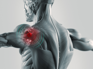 3d Illustration Chronic Shoulder Pain Health And Wellness
