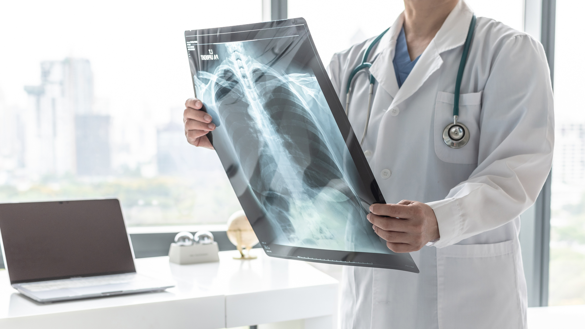 Doctorwith X Ray Of Lungs Disease Health